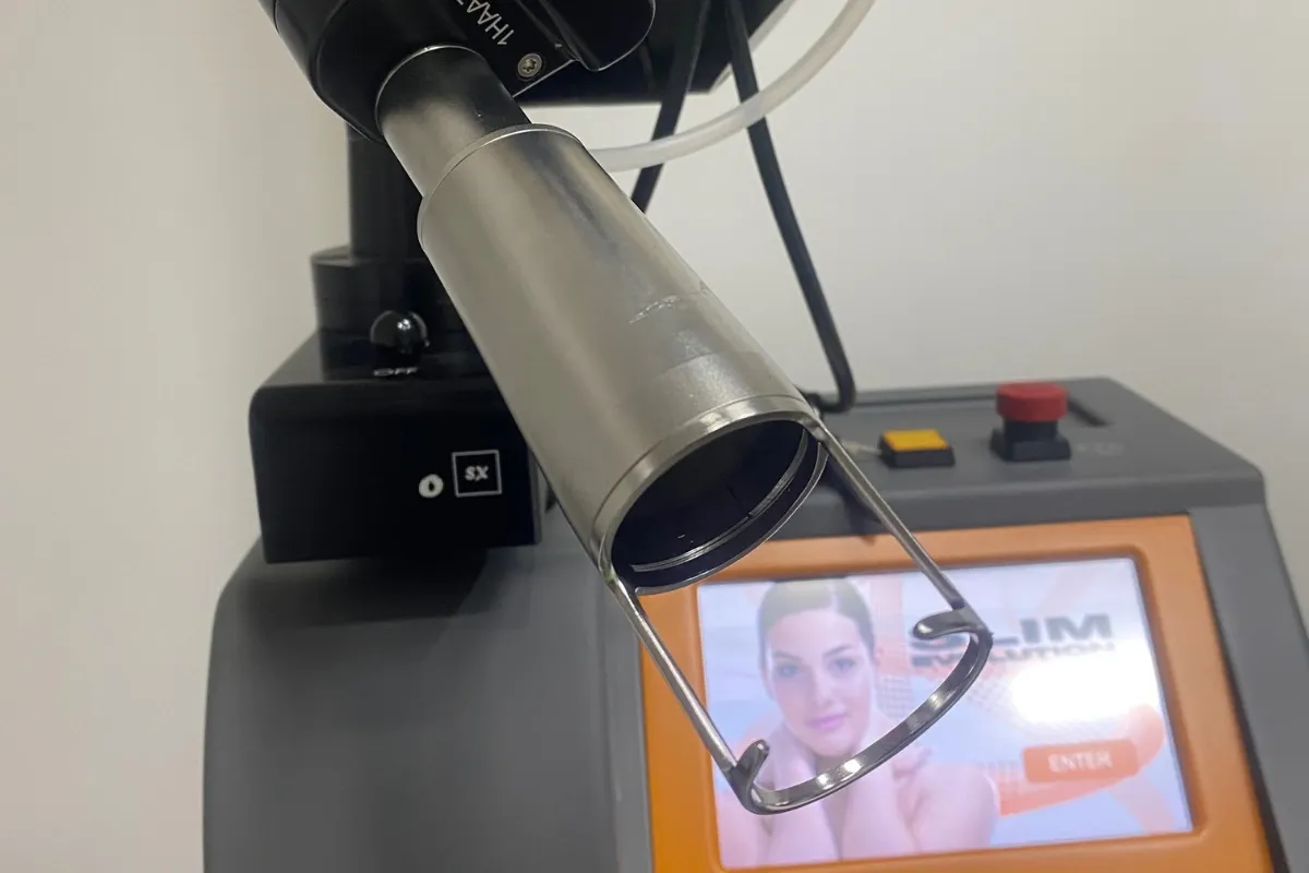 Rimozione delle cicatrici acneiche e post intervento