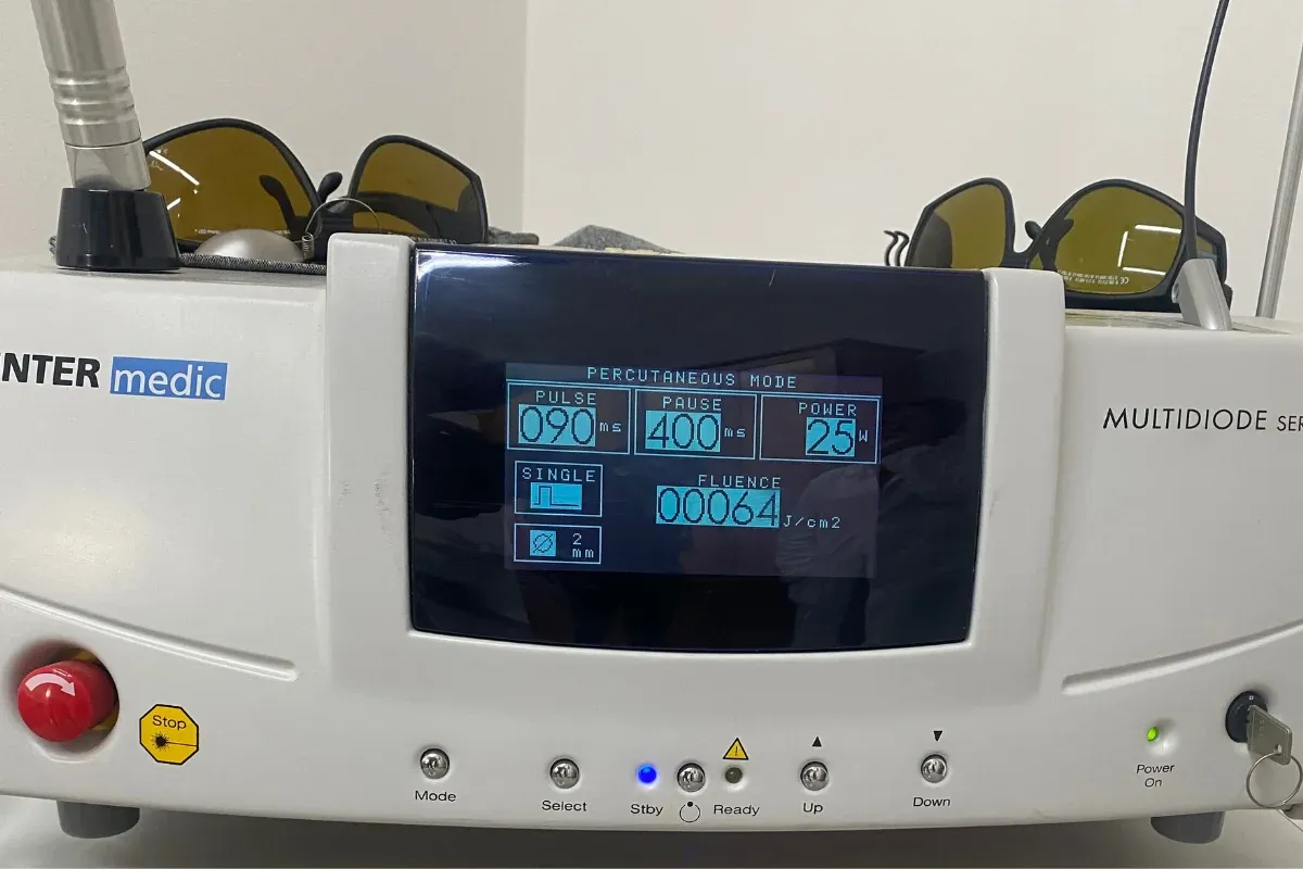 Trattamento dei Capillari viso ed arti inferiori, Couperose, Spider nevi, Angioma piano ed Haemangioma